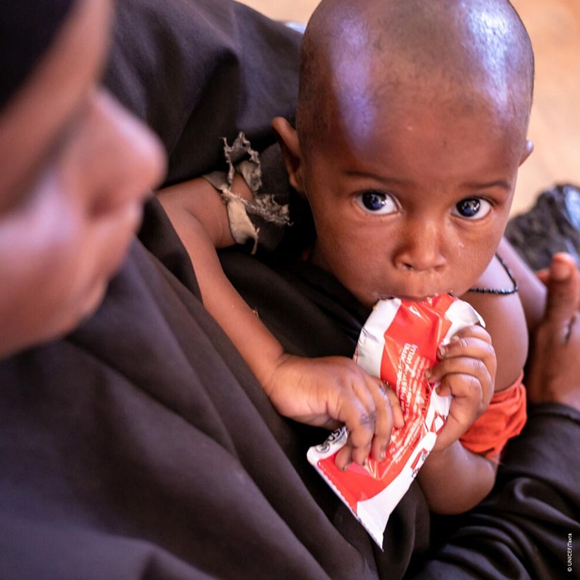 UNICEF: Świat jest u progu katastrofalnego poziomu niedożywienia u dzieci
